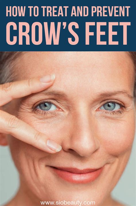 how to prevent crows feet wrinkles